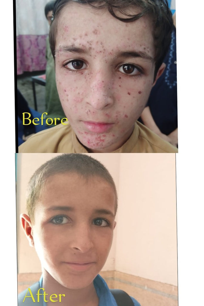 Pediatric Activity in Lahore, Pakistan - Sep 18, 2026